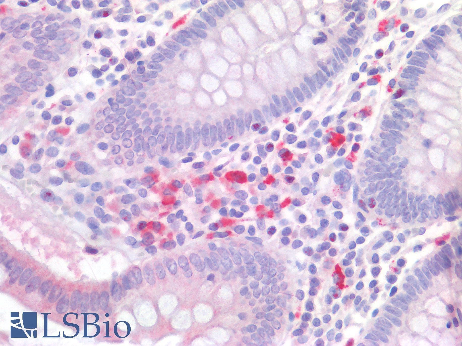 IHC-plus™ IL17A Antibody