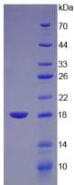 Chicken LYZ / Lysozyme Protein (Recombinant His, N-Terminal)