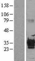 PCA1 / ALKBH3 Protein (Over-Expression Lysate Myc-DDK (Flag))
