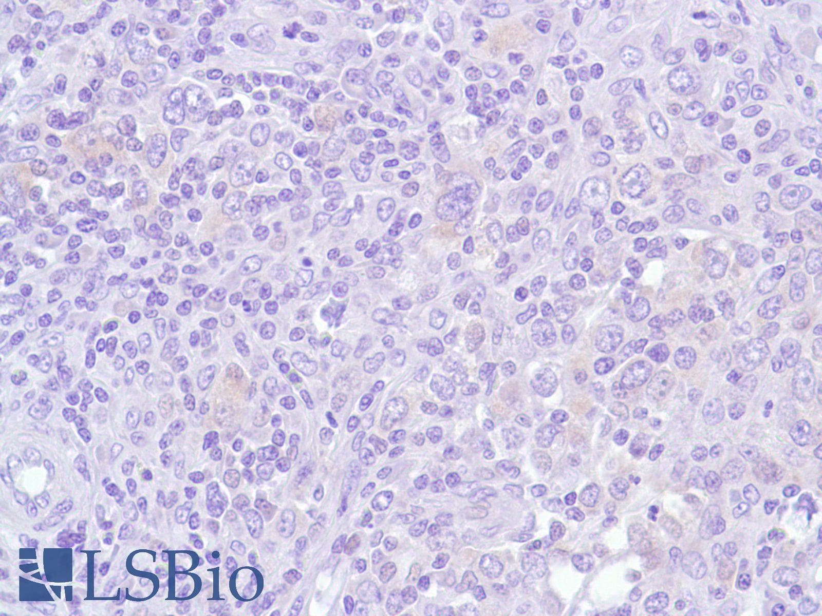 Monoclonal Rabbit anti-Human BCL6 Antibody (clone SP155, C-Terminus, IHC)