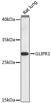GLIPR1 / GLIPR Antibody