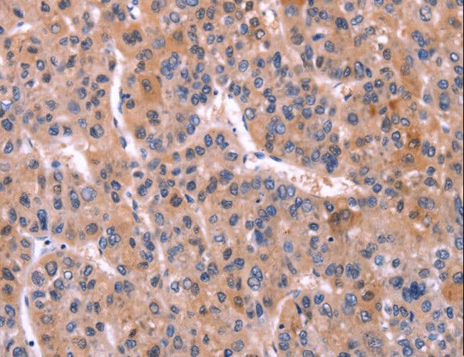 TNFRSF17 / BCMA Antibody