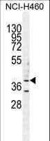 Polyclonal Rabbit anti-Human B3GALT5 Antibody (aa57-84, WB)