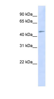 Polyclonal Rabbit anti-Human C3orf17 / NET17 Antibody (aa324-373, WB)