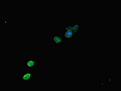 KIAA0833 / CAMTA1 Antibody