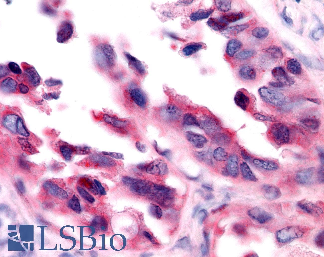 PathPlus™ EAR2 / NR2F6 Antibody (N-Terminus)