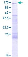 Human FUK Protein (Recombinant GST)