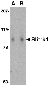 SLITRK1 Antibody