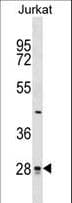 CTDSP1 / SCP1 Antibody (aa1-30)