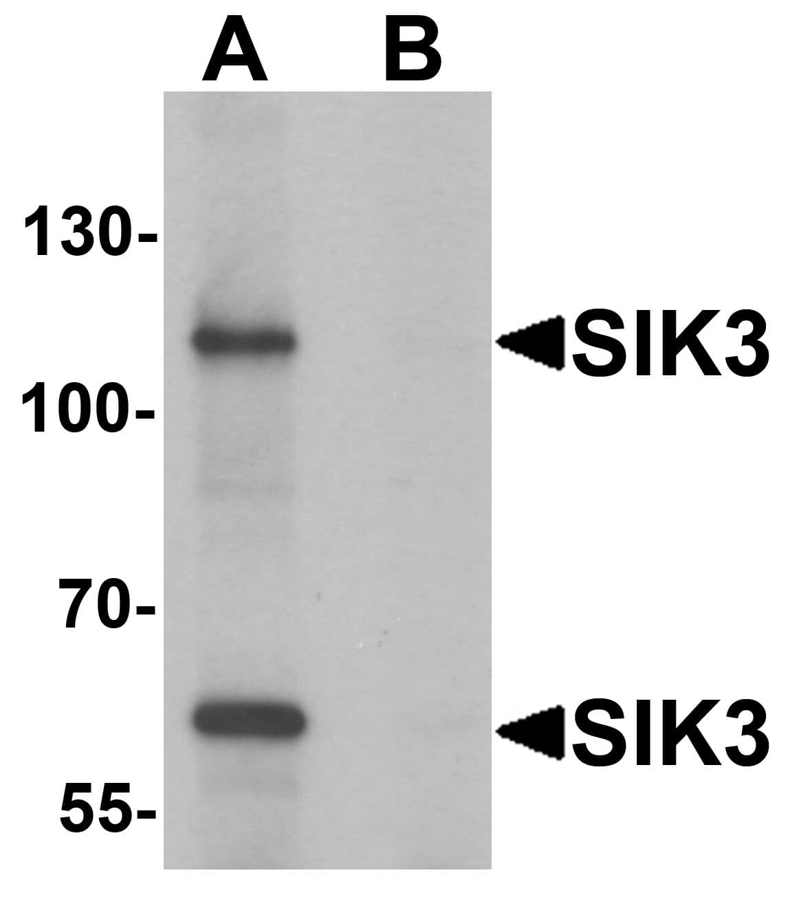 IHC-plus™ SIK3 / QSK Antibody
