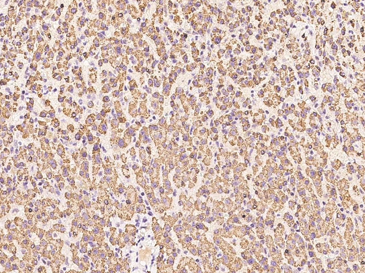 ENPP2 / Autotaxin Antibody (Preservative Free)