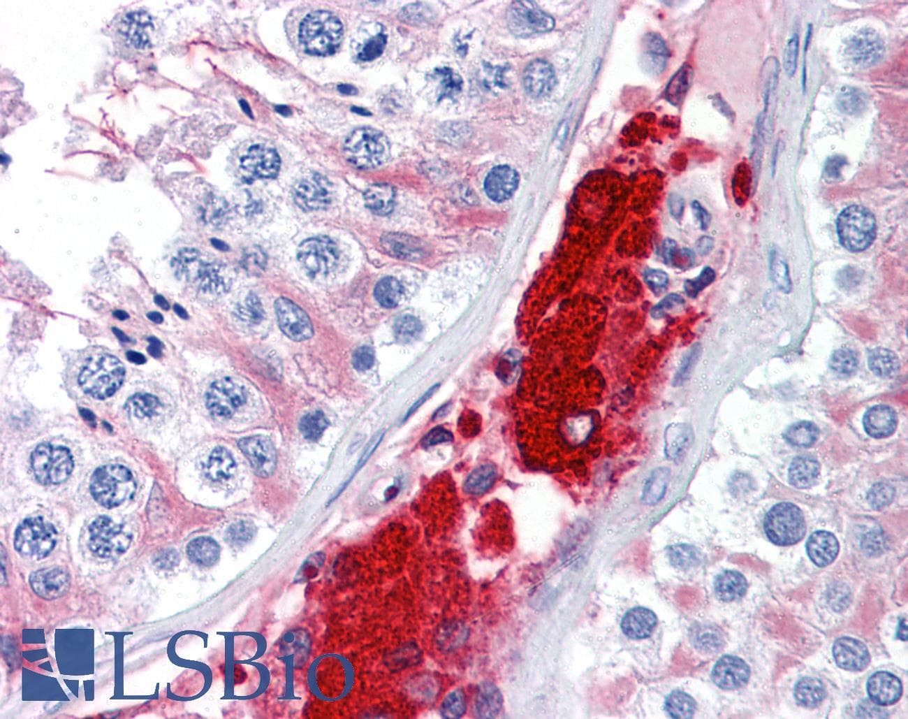 IHC-plus™ CDC123 Antibody (clone 4B9)