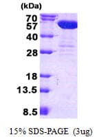 Human CNDP2 Protein (Recombinant His)