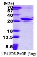 Human GAS41 Protein (Recombinant His)