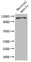 EPHB6 / EPH Receptor B6 Antibody