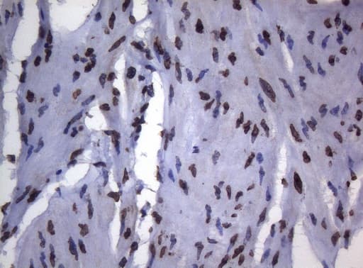 BCL6 Antibody (aa1-300, clone OTI1C3, Carrier-free)