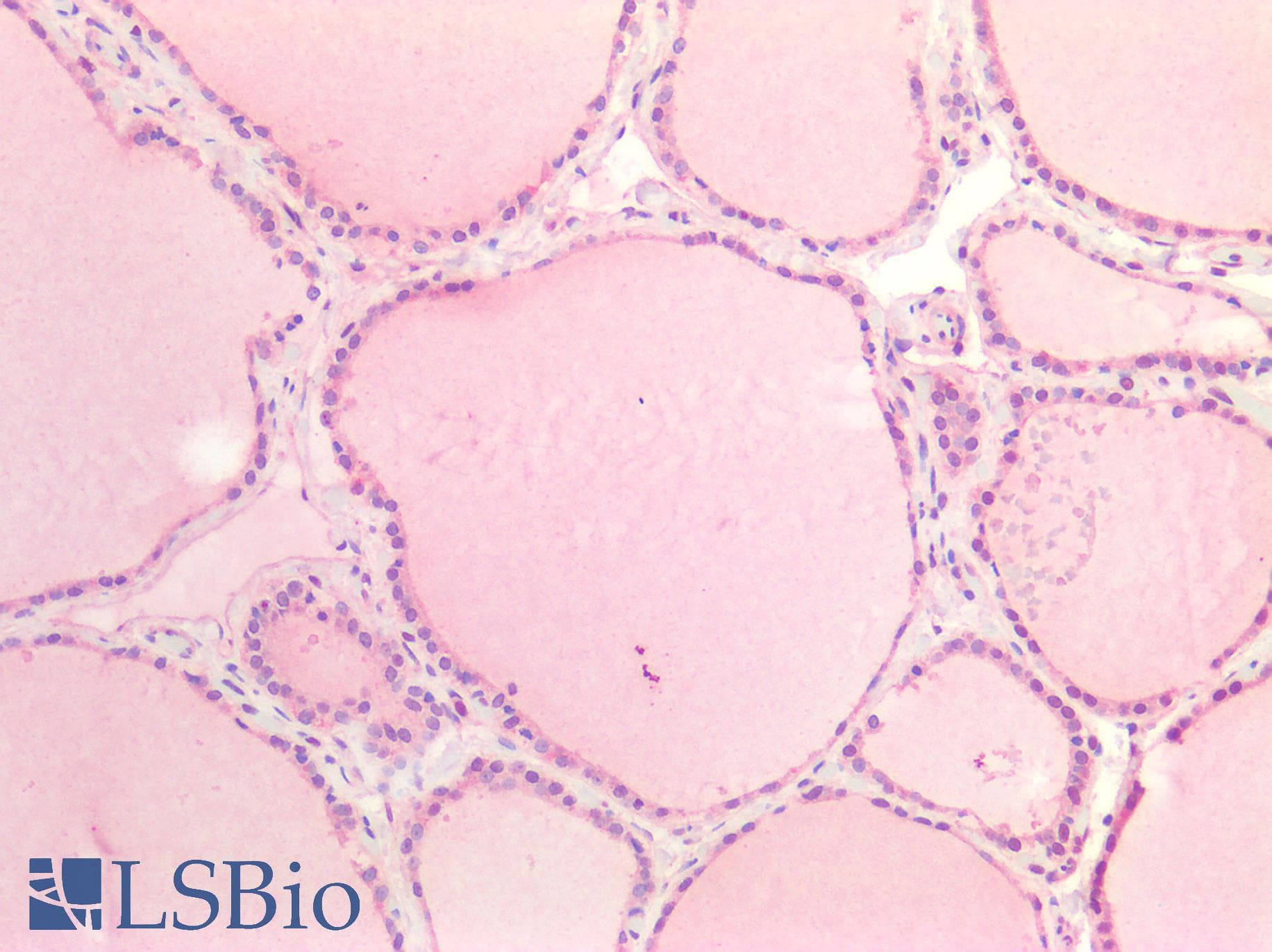 IHC-plus™ ALK2 / ACVR1 Antibody (aa20-125)