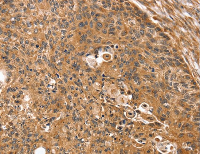 Polyclonal Rabbit anti-Human SSX2IP Antibody (IHC)