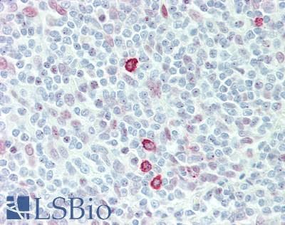 IHC-plus™ Polyclonal Rabbit anti-Human ERIC-1 / TACC3 Antibody (aa375-425, IHC, WB)