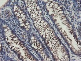 SENP2 Antibody (aa139-523, clone OTI1B8)