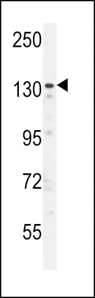 Polyclonal Rabbit anti-Human ZNF536 Antibody (aa203-231, IHC, WB)