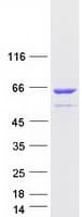 Human EDC3 Protein (Recombinant Myc-DDK (Flag))