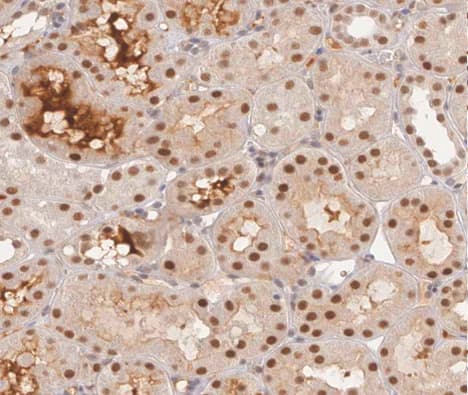 GYS1 / Glycogen Synthase Antibody (phospho-Ser645)