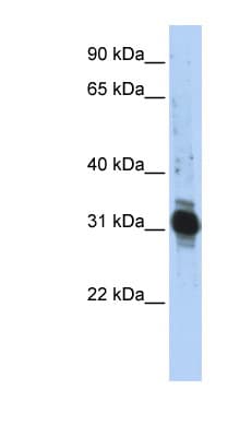 ZFAND3 / TEX27 Antibody (aa72-121)