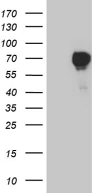 Monoclonal Mouse anti-Human FOXC2 Antibody (clone OTI2G5, aa1-280, WB)