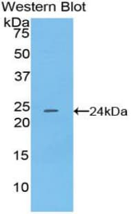 NCL / Nucleolin Antibody (aa388-569, Biotin)