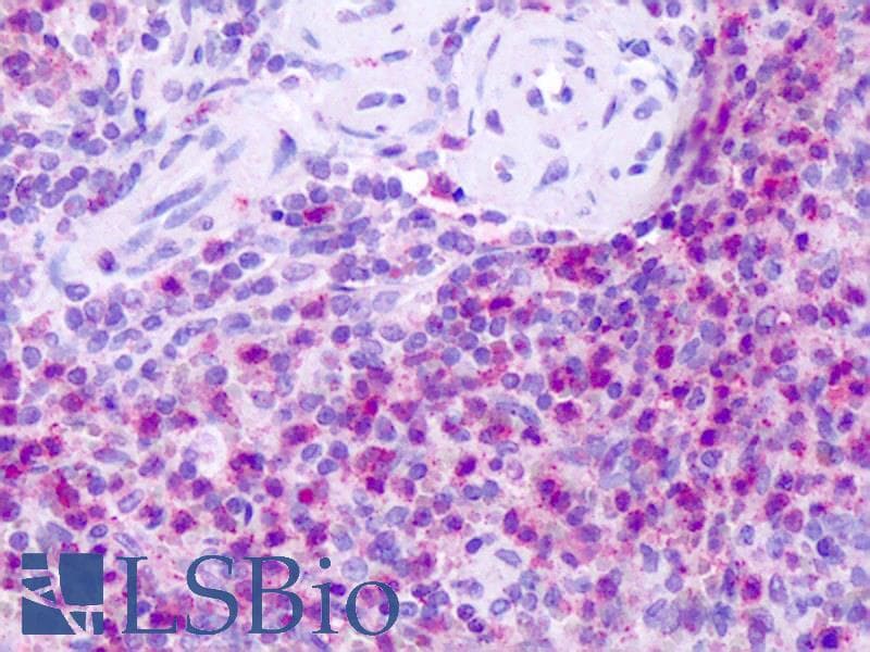 IHC-plus™ TACR1 / NK1R Antibody (C-Terminus)