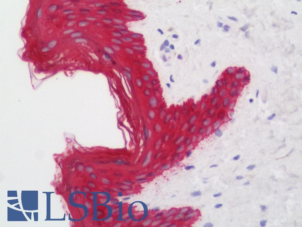 PathPlus™ Monoclonal Mouse anti-Human KRT19 / CK19 / Cytokeratin 19 Antibody (clone 3F8, IHC, IF, WB)