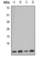PCBD1 / PHS Antibody