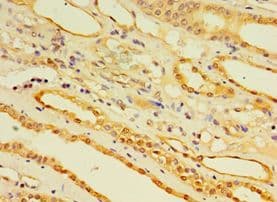 Polyclonal Rabbit anti-Human EGLN3 / PHD3 Antibody (aa1-120, IHC)