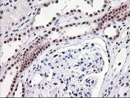 MGLL / Monoacylglycerol Lipase Antibody (clone OTI2B11)