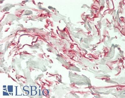 IHC-plus™ ELN / Elastin Antibody