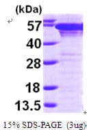 Human PDI / P4HB Protein (Recombinant His)