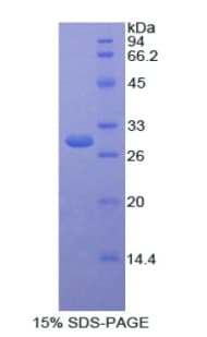 Human Selenium Binding Protein 1 (Recombinant His)