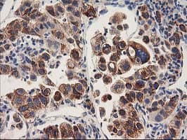 HARS2 Antibody (clone OTI6F9, Carrier-free)