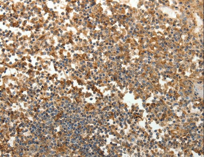 Polyclonal Rabbit anti-Human SFTPD / Surfactant Protein D Antibody (IHC)