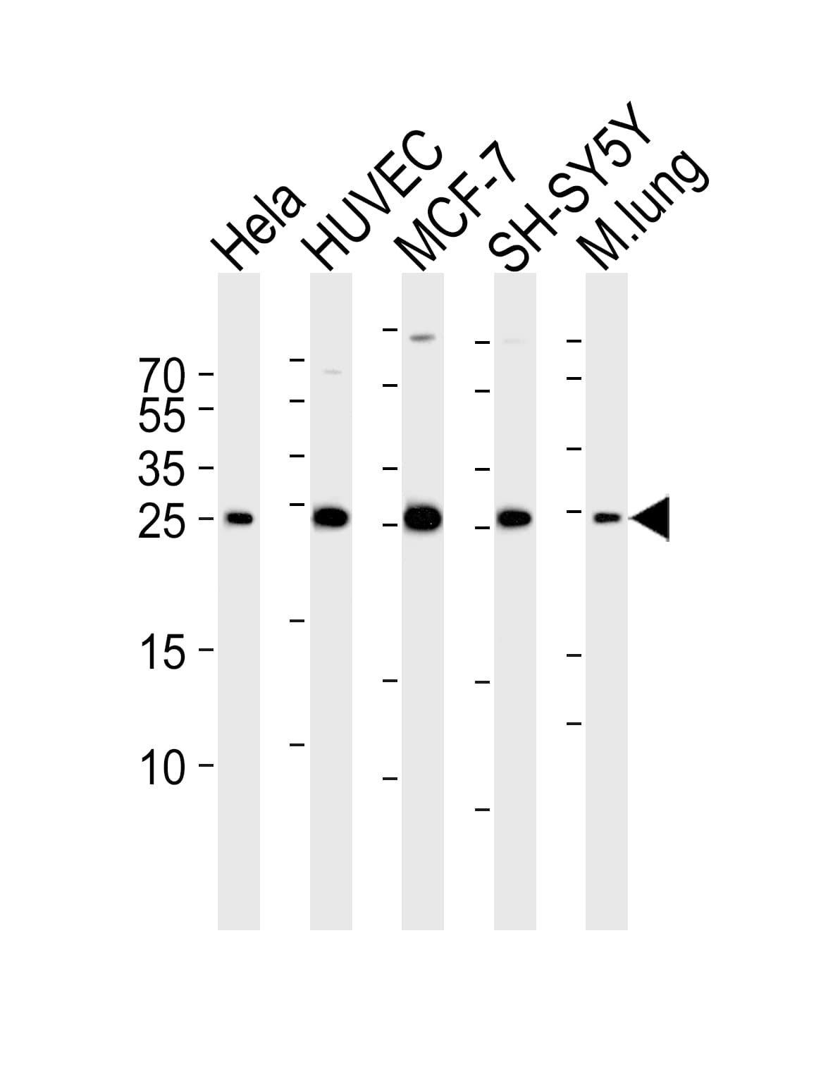 Polyclonal Rabbit anti-Human CDKN1A / WAF1 / p21 Antibody (aa133-164, IF, WB)