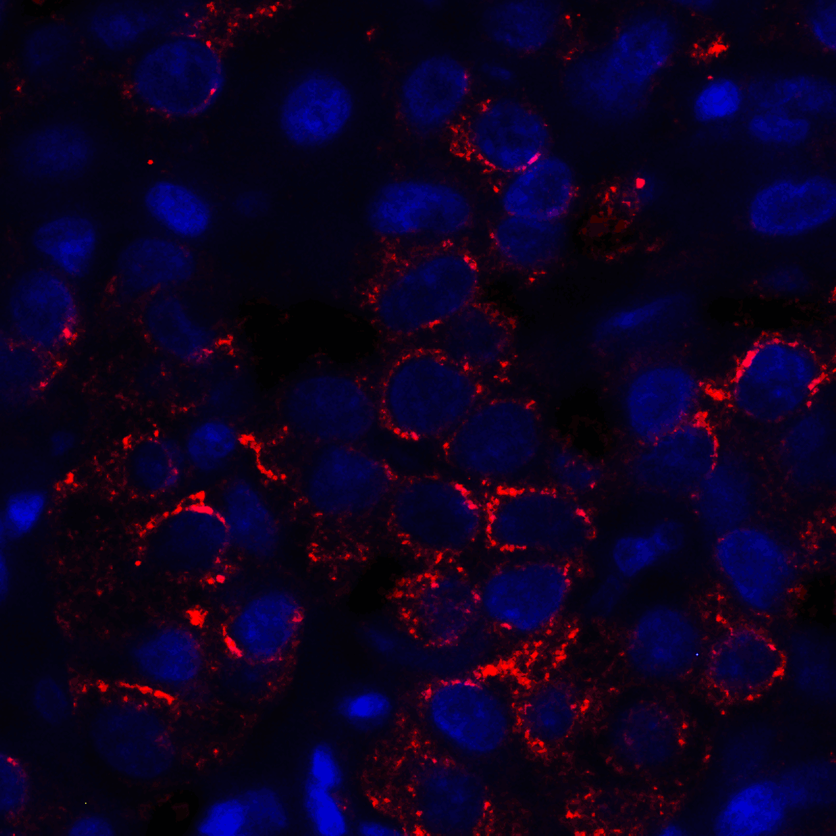 IHC-plus™ Monoclonal Mouse anti-Human VSIR / GI24 / VISTA Antibody (clone 4C4, IHC, IF, WB)