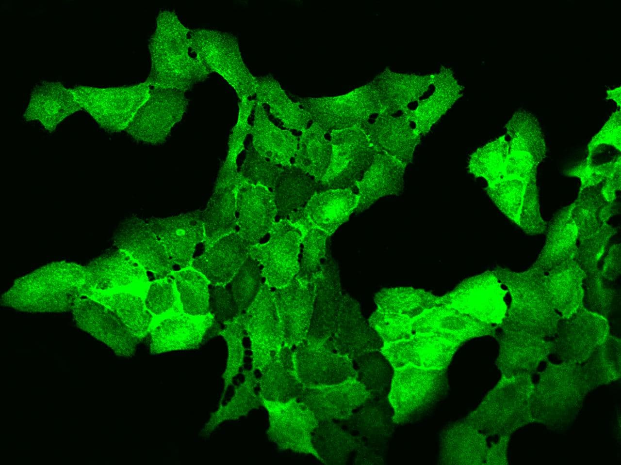 AHNAK2 Antibody