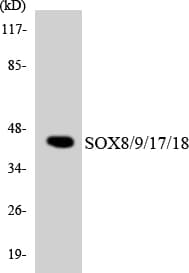 Sox8+9+17+18 Antibody (aa99-148)