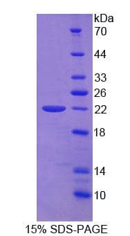 Human ADAMTS13 Protein (Recombinant)