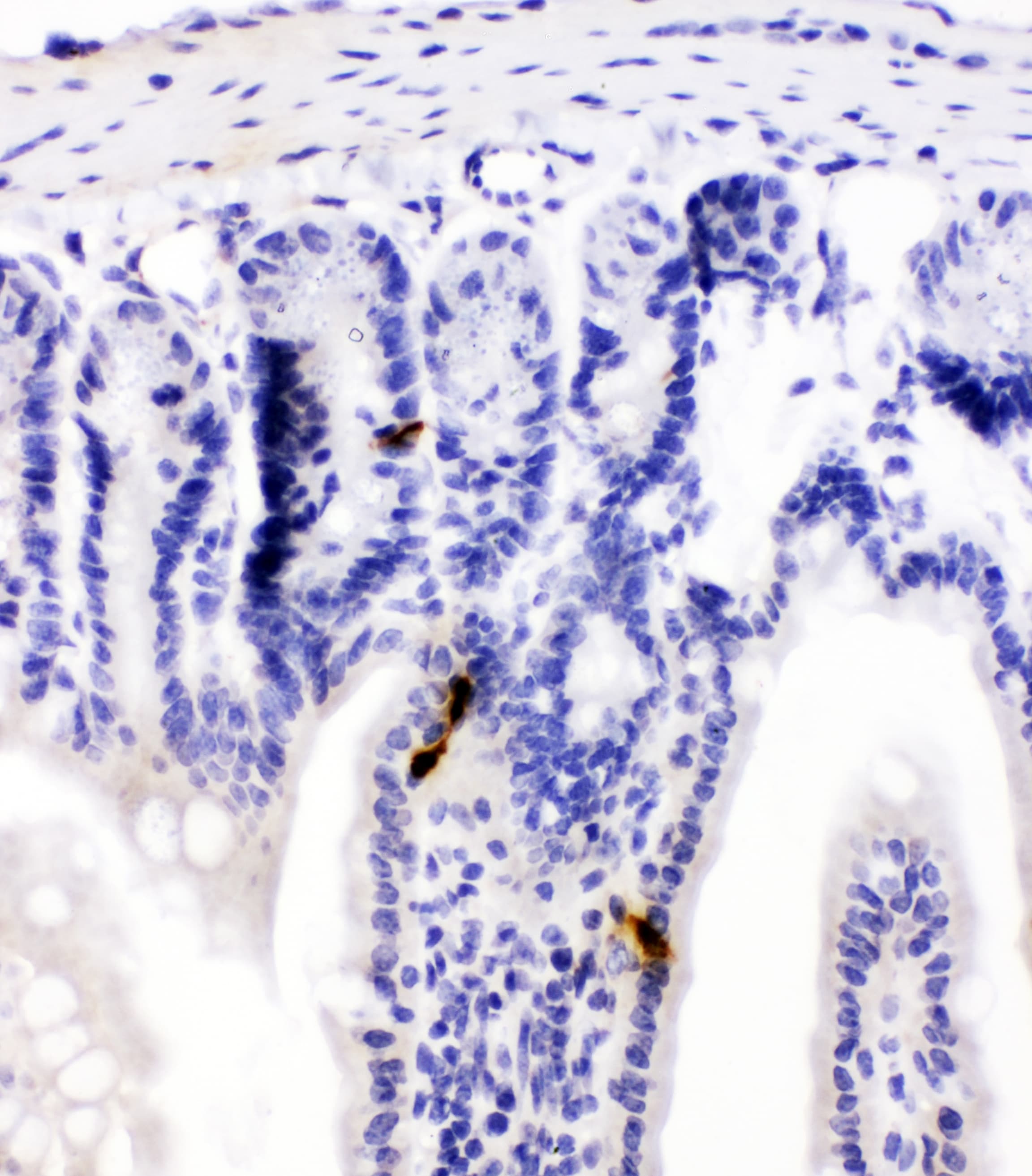 Peptide YY / PYY Antibody
