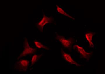 PRKCZ / PKC-Zeta Antibody
