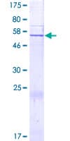 Human ALKBH8 Protein (Recombinant GST)
