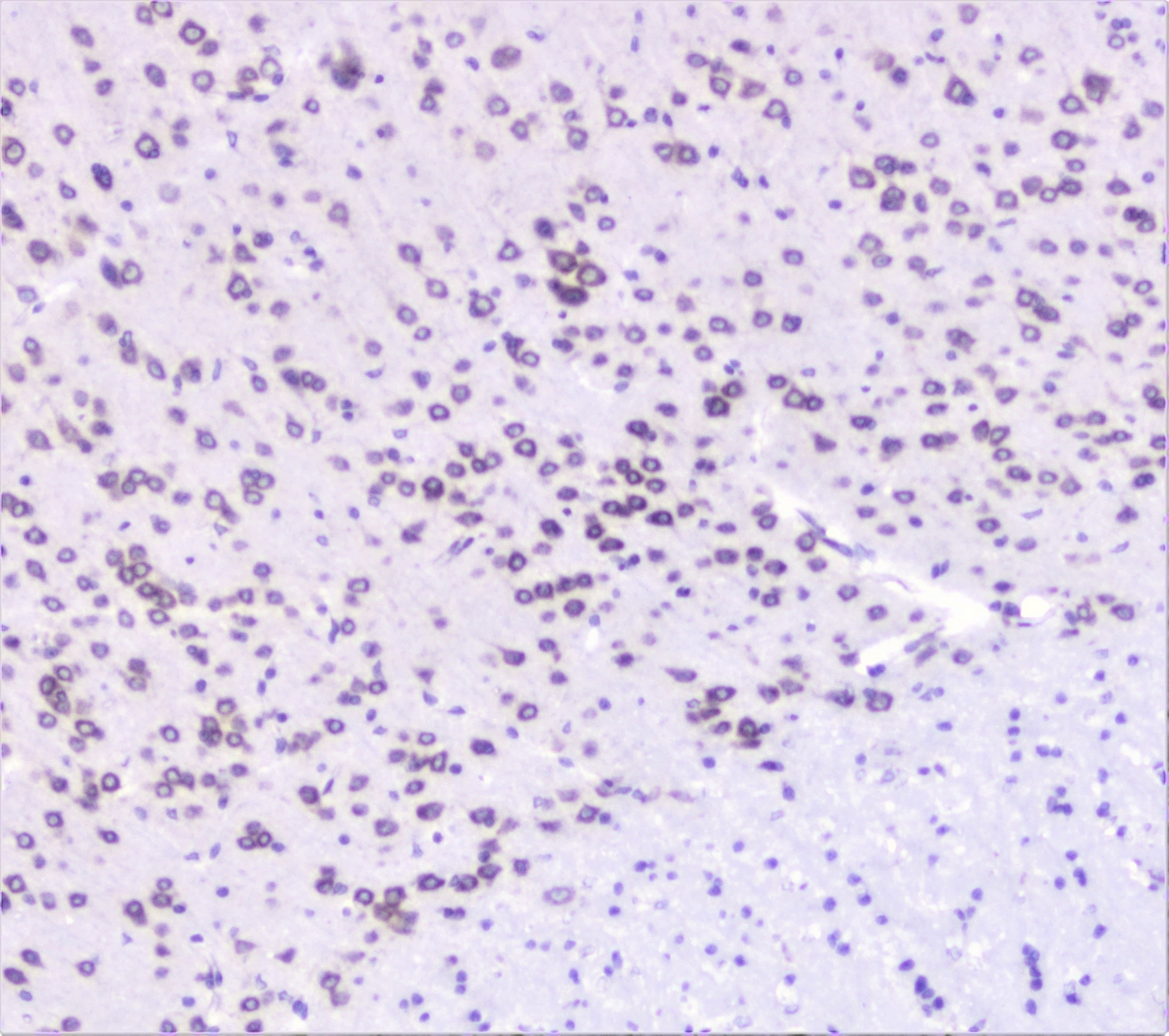 UBE2I / UBC9 Antibody