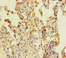 CCDC184 Antibody